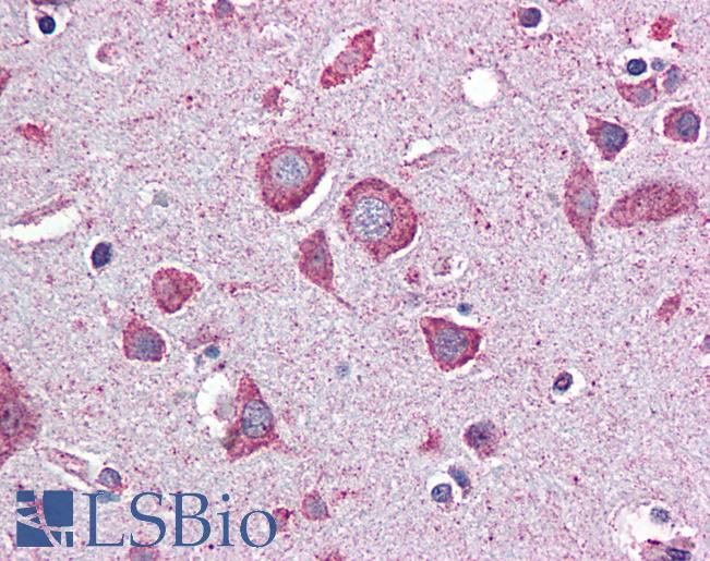 Anti-EIF2B2 / EIF2B antibody IHC of human brain, cortex. Immunohistochemistry of formalin-fixed, paraffin-embedded tissue after heat-induced antigen retrieval. Antibody LS-B6193 concentration 5 ug/ml.
