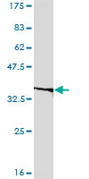 Antibody LS-B6193, Western blot of EIF2B2 expression in HeLa.
