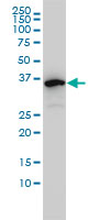Antibody LS-B6193, Western blot of EIF2B2 expression in K-562.