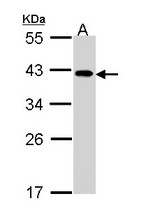 Sample (30 ug of whole cell lysate). A: A431 . 10% SDS PAGE. EIF2B2 antibody diluted at 1:1000.