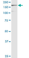 EIF3A monoclonal antibody (M02), clone 2G4. Western blot of EIF3A expression in HepG2.