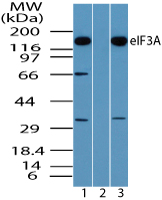 Western blot of eIF3A in Daudi cell lysate in the 1) absence and 2) presence of immunizing peptide and 3) NIH 3T3 cell lysate using LS-B7957 at 0.5 ug/ml, 0.5 ug/ml and 0.25 ug/ml respectively.