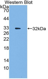 Western blot of recombinant EIF3A / EIF3.