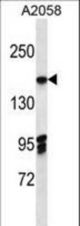 EIF3A Antibody western blot of A2058 cell line lysates (35 ug/lane). The EIF3A antibody detected the EIF3A protein (arrow).