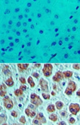 IHC of eIF4A1 in formalin-fixed, paraffin-embedded human liver tissue using an isotype control (top) and LS-C148474 (bottom) at 5 ug/ml.