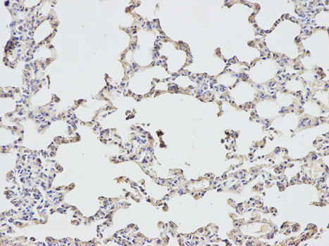 Immunohistochemistry of paraffin-embedded rat lung using EIF4A1 antibody at dilution of 1:200 (200x lens).