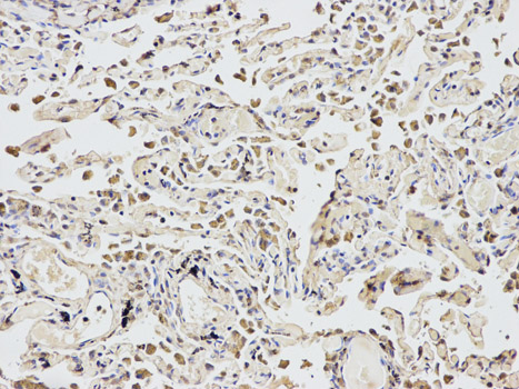 Immunohistochemistry of paraffin-embedded human lung using EIF4A1 antibody at dilution of 1:200 (200x lens).