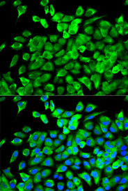 Immunofluorescence analysis of MCF-7 cell using EIF4A1 antibody. Blue: DAPI for nuclear staining.