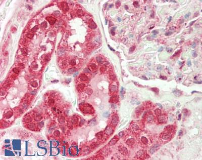 Human Kidney: Formalin-Fixed, Paraffin-Embedded (FFPE)