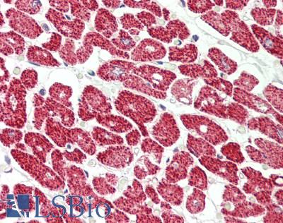 Human Heart: Formalin-Fixed, Paraffin-Embedded (FFPE)