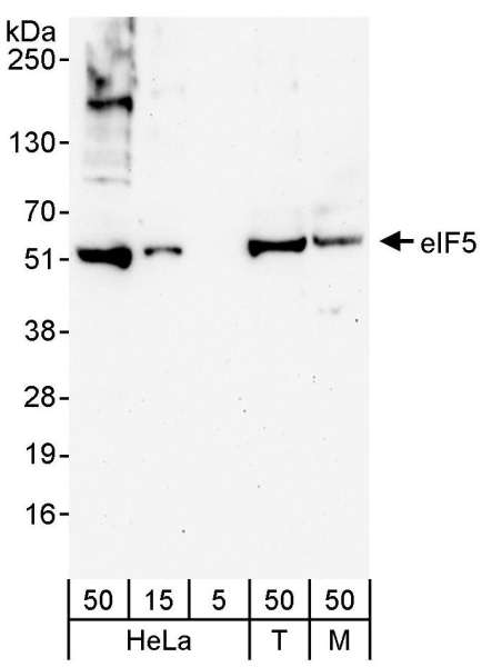 Detection of Human and Mouse eIF5 by Western Blot. Samples: Whole cell lysate from HeLa (5, 15 and 50 ug for WB; 1 mg for IP, 20% of IP loaded), 293T (T; 50 ug), and mouse NIH3T3 (M; 50 ug) cells. Antibody: Affinity purified rabbit anti-eIF5 antibody used for WB at 0.04 ug/ml. Detection: Chemiluminescence with an exposure time of 3 minutes.