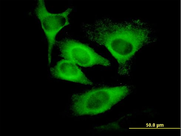 Immunofluorescence of monoclonal antibody to EIF5 on HeLa cell. [antibody concentration 10 ug/ml]