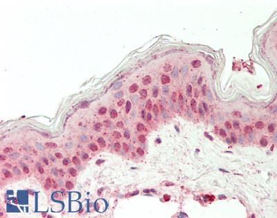 Human Skin: Formalin-Fixed, Paraffin-Embedded (FFPE)