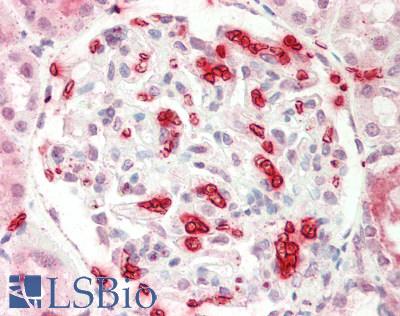 Human Kidney: Formalin-Fixed, Paraffin-Embedded (FFPE)