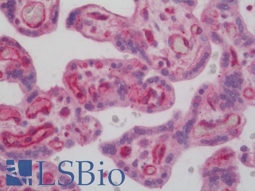 Human Placenta: Formalin-Fixed, Paraffin-Embedded (FFPE)