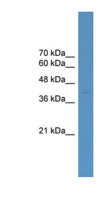 ELK4 antibody LS-C134927 Western blot of 721_B cell lysate.