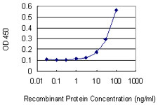 Detection limit for recombinant GST tagged ELK4 is 3 ng/ml as a capture antibody.