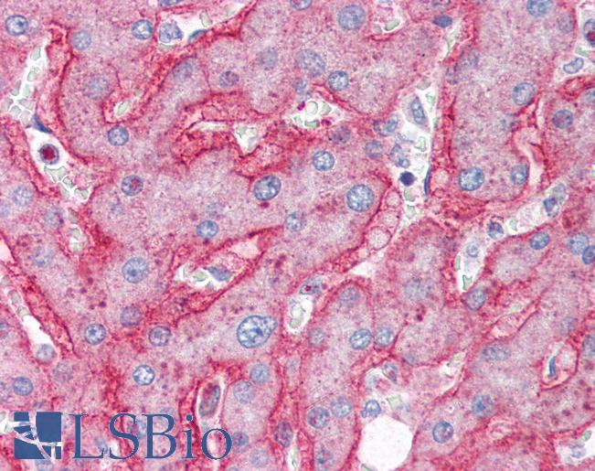 Anti-ENPP1 antibody IHC of human liver. Immunohistochemistry of formalin-fixed, paraffin-embedded tissue after heat-induced antigen retrieval. Antibody LS-B2335 concentration 5 ug/ml.