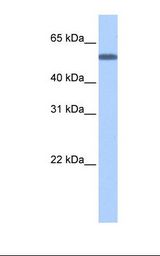 Fetal brain cell lysate. Antibody concentration: 0.5 ug/ml. Gel concentration: 12%.