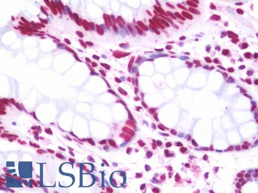 Anti-CSB / ERCC6 antibody IHC staining of human colon. Immunohistochemistry of formalin-fixed, paraffin-embedded tissue after heat-induced antigen retrieval. Antibody LS-B10773 concentration 7.5 ug/ml.