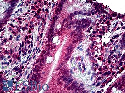 Anti-ERCC6 antibody IHC of human small intestine. Immunohistochemistry of formalin-fixed, paraffin-embedded tissue after heat-induced antigen retrieval. Antibody LS-B5098 concentration 3.75 ug/ml.