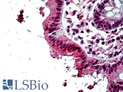 Anti-ERCC6 antibody IHC of human colon. Immunohistochemistry of formalin-fixed, paraffin-embedded tissue after heat-induced antigen retrieval. Antibody LS-B5098 concentration 3.75 ug/ml.