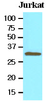 Cell lysates of Jurkat (30 ug) were resolved by SDS-PAGE, transferred to NC membrane and probed with anti-human Tollip (1:500). Proteins were visualized using a goat anti-mouse secondary antibody conjugated to HRP and an ECL detection system.
