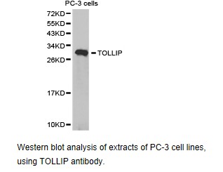 Western blot.