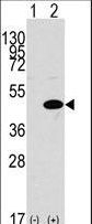 Western blot of ERK1 (arrow) using rabbit ERK1 antibody.293 cell lysates (2 ug/lane) either nontransfected (Lane 1) or transiently transfected with the MAPK1 gene (Lane 2) (Origene Technologies).