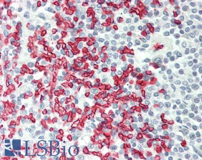 Human Spleen: Formalin-Fixed, Paraffin-Embedded (FFPE)