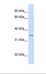 Hela cell lysate. Antibody concentration: 1.0 ug/ml. Gel concentration: 12%.