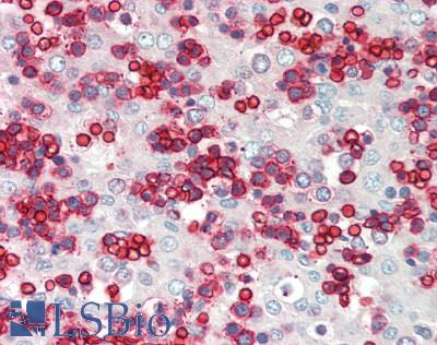 Human Fetal Liver: Formalin-Fixed, Paraffin-Embedded (FFPE)