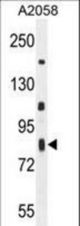 C6orf70 Antibody western blot of A2058 cell line lysates (35 ug/lane). The C6orf70 antibody detected the C6orf70 protein (arrow).