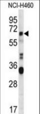 HERV-FRD Antibody western blot of NCI-H460 cell line lysates (35 ug/lane). The HERV-FRD antibody detected the HERV-FRD protein (arrow).