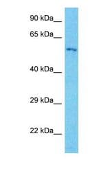 Western blot of ERVFRD-1 Antibody with human Thymus Tumor lysate.