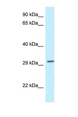 TOLLIP antibody LS-C145755 Western blot of Mouse Brain lysate. Antibody concentration 1 ug/ml.