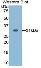Western blot of recombinant TOLLIP.