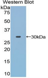 Western blot of recombinant TOLLIP.