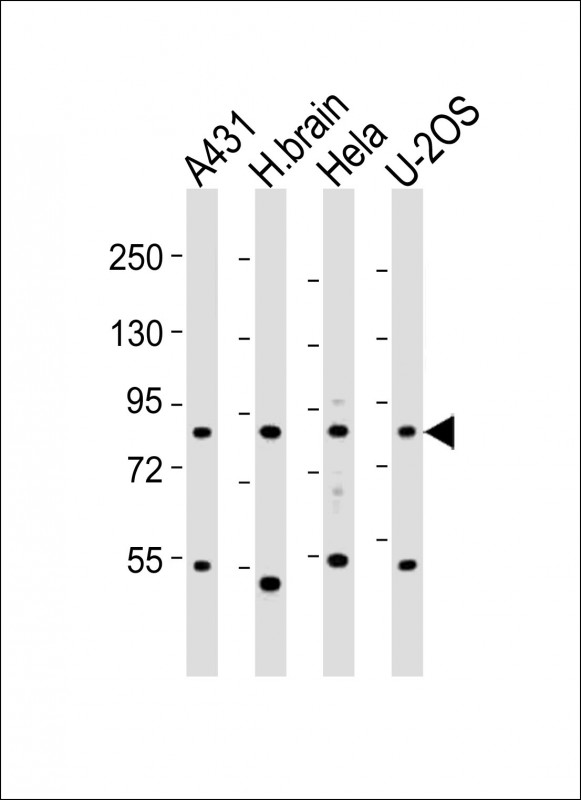 All lanes : Anti-EXOC3 Antibody at 1:2000 dilution Lane 1: A431 whole cell lysates Lane 2: human brain lysates Lane 3: HeLa whole cell lysates Lane 4: U-2OS whole cell lysates Lysates/proteins at 20 ug per lane. Secondary Goat Anti-Rabbit IgG, (H+L), Peroxidase conjugated at 1/10000 dilution Predicted band size : 87 kDa Blocking/Dilution buffer: 5% NFDM/TBST.