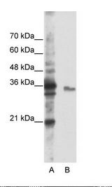 A: Marker, B: Jurkat Cell Lysate