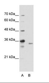 B: HepG2 Cell Lysate