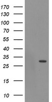 HEK293T cells were transfected with the pCMV6-ENTRY control (Left lane) or pCMV6-ENTRY EXOSC3 (Right lane) cDNA for 48 hrs and lysed. Equivalent amounts of cell lysates (5 ug per lane) were separated by SDS-PAGE and immunoblotted with anti-EXOSC3.