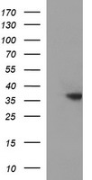 HEK293T cells were transfected with the pCMV6-ENTRY control (Left lane) or pCMV6-ENTRY TOLLIP (Right lane) cDNA for 48 hrs and lysed. Equivalent amounts of cell lysates (5 ug per lane) were separated by SDS-PAGE and immunoblotted with anti-TOLLIP.