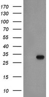 HEK293T cells were transfected with the pCMV6-ENTRY control (Left lane) or pCMV6-ENTRY EXOSC3 (Right lane) cDNA for 48 hrs and lysed. Equivalent amounts of cell lysates (5 ug per lane) were separated by SDS-PAGE and immunoblotted with anti-EXOSC3.