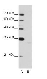 A: Marker, B: Jurkat Cell Lysate