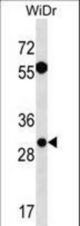 EXOSC6 Antibody western blot of WiDr cell line lysates (35 ug/lane). The EXOSC6 antibody detected the EXOSC6 protein (arrow).