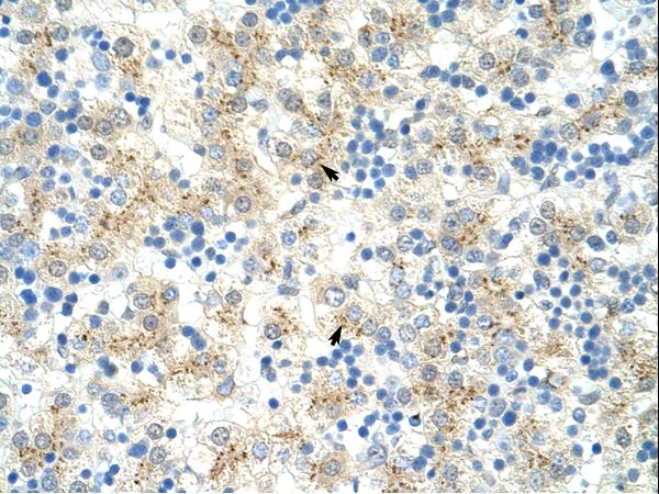EXOSC6 antibody LS-C30677 was used in IHC to stain formalin-fixed, paraffin-embedded human liver.