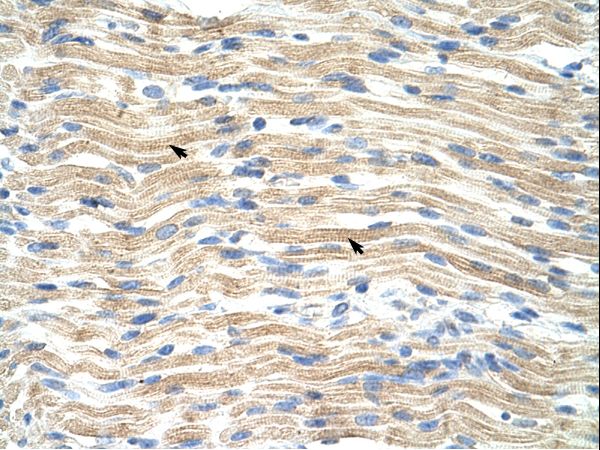 EXOSC6 antibody LS-C30677 was used in IHC to stain formalin-fixed, paraffin-embedded human muscle.
