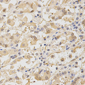 Immunohistochemistry of paraffin-embedded human stomach using TOLLIP antibody at dilution of 1:200 (x400 lens).