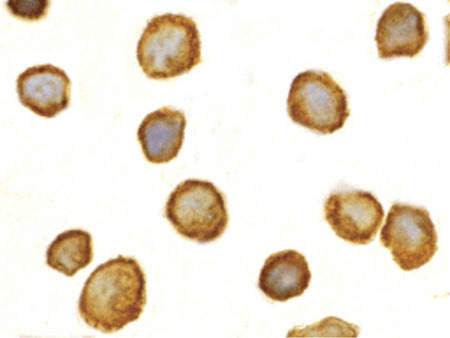 Immunocytochemistry of TOLLIP in THP-1 cells with TOLLIP antibody at 2 ug/ml.